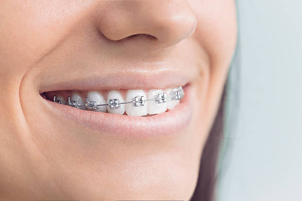 Laser Dentistry in Heath, TX